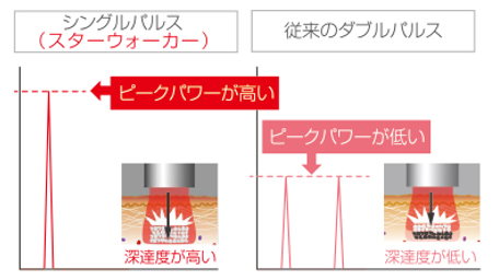 高ピークパワー