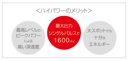 ハイパワー