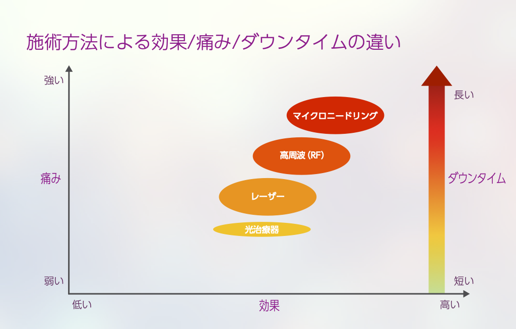 レーザー治療と光治療（IPL）の違い
