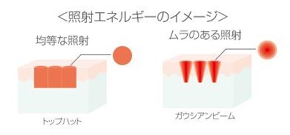 理想的なビームプロファイル